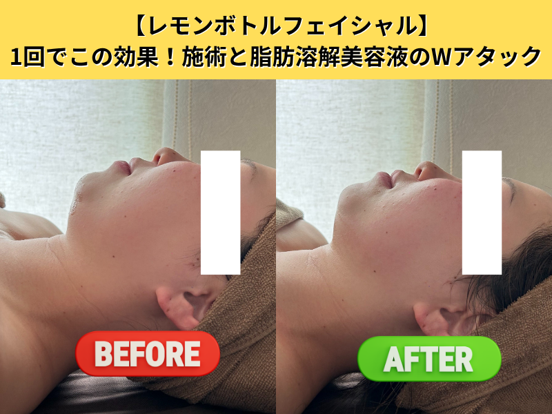 ビフォーアフター2