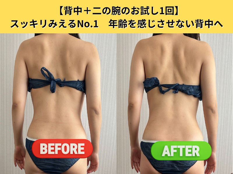 ビフォーアフター3