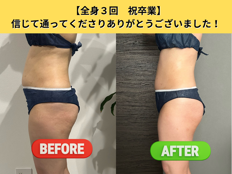 ビフォーアフター4
