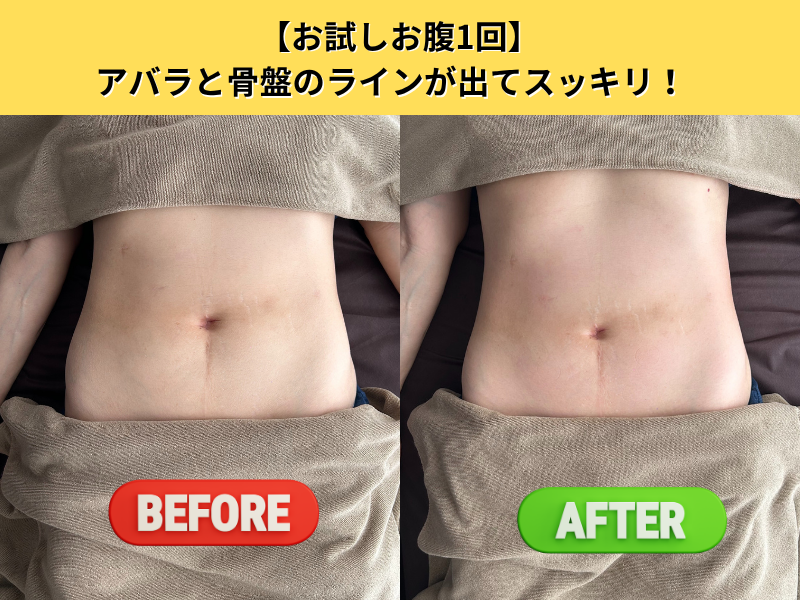 ビフォーアフター6