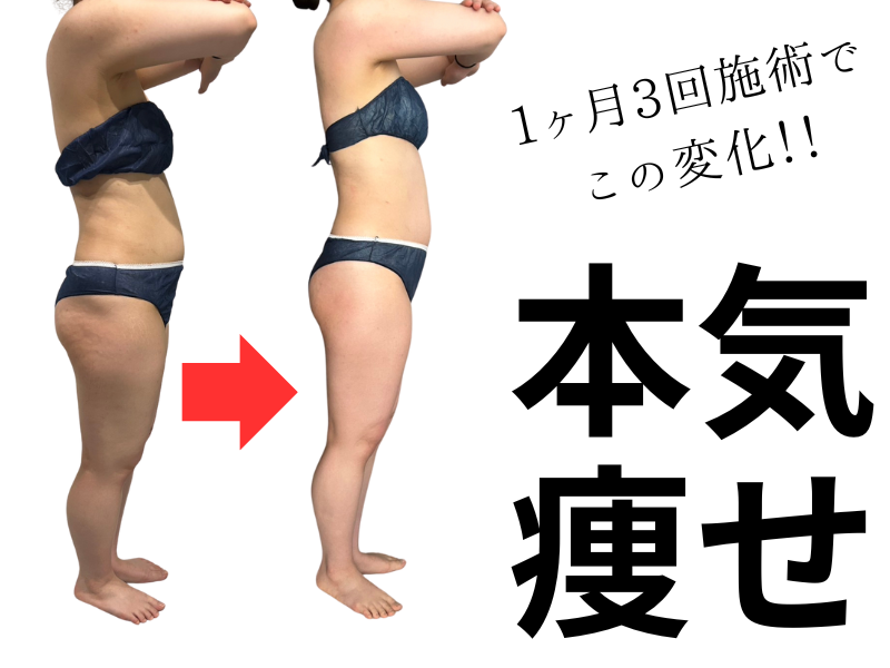 ビフォーアフター1